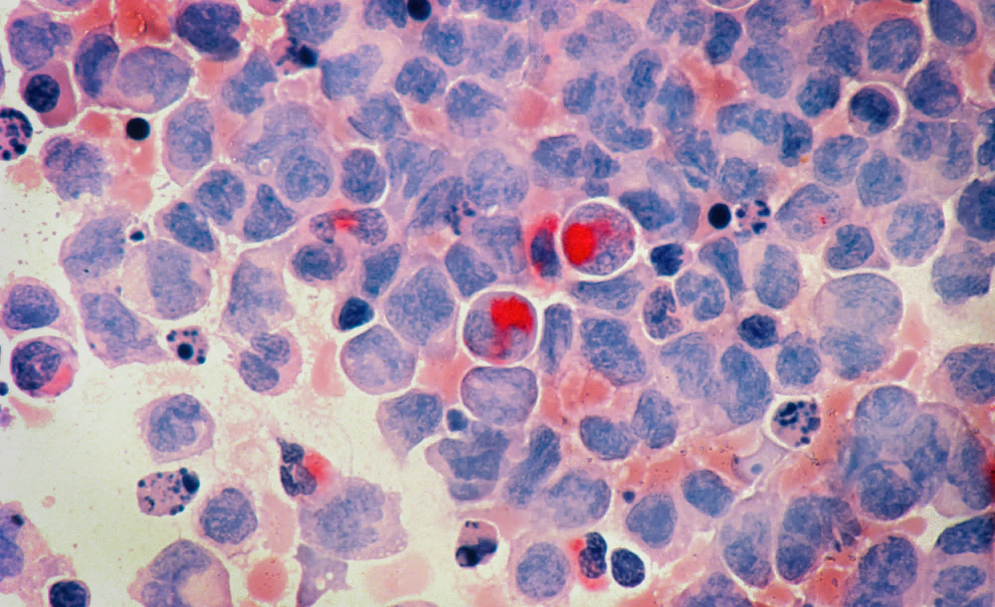 googlein yapay zekasi kanser konusunda onemli bir kesif yapti ipfJgGjW.jpg