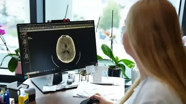 kume bas agrisi nedir belirtileri nelerdir uzmanindan onemli uyarilar wFROhnar.webp